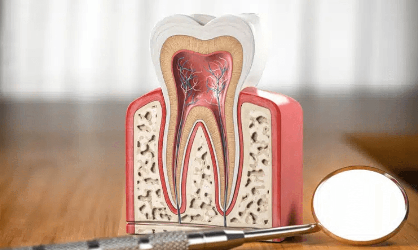 Is Your Tooth Pain Telling You That You Need a Root Canal?